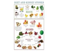 Kidney Stone Risk Reduction Diet, Oxalate Food Chart & Hydration Guide with Calcium Tips for Kitchen Wall Reference(Unframed,16x24inch(40x60cm))