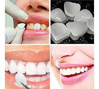 Kit di sostituzione temporanea dei denti, strisce sbiancanti per i denti, semplice e pratico, adatto a tutte le forme dei denti, migliora la fiducia e il fascino del sorriso Tagli Unica,Bianco + Giall