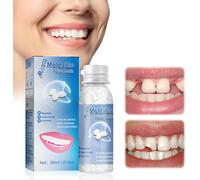 Kit Otturazione Denti, Cemento per Denti 30ml Granuli Di Riparazione Denti Falsi