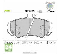 Kit Pastiglie freno Valeo Anteriore per HYUNDAI ELANTRA