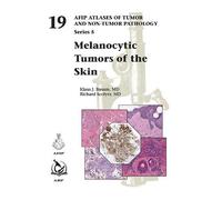 Klaus J. Busam Richard Scolyer Kara Melanocytic Tumors of th (Copertina rigida)