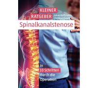 Kleiner Ratgeber Spinalkanalstenose: In 10 Schritten durch die Operation