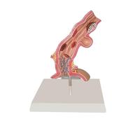 KMHHAG Modello di anatomia patologica esofagea umana Strumento di educazione di scienza medica