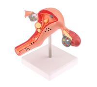 KMHHAG Modello medico di anatomia del modello patologico del sistema riproduttivo femminile per l'insegnamento & l'esposizione