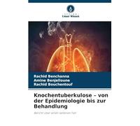 Knochentuberkulose - von der Epidemiologie bis zur Behandlung: Bericht über einen seltenen Fall
