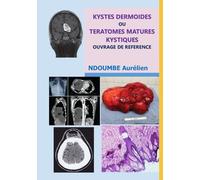 kystes dermoïdes ou tératomes matures kystiques -: ouvrage de référence