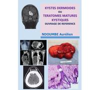 kystes dermoïdes ou tératomes matures kystiques -: ouvrage de référence