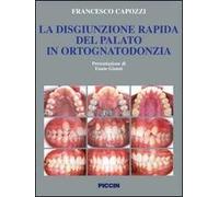 La disgiunzione rapida del palato in ortognatodonzia