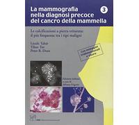 La mammografia nella diagnosi precoce del cancro della mammella. Le calcificazioni a pietra triturata. Il più frequente tra i tipi maligni. Con occhiali 3D