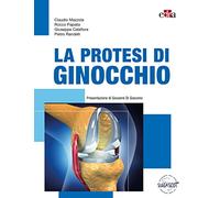 La protesi di ginocchio