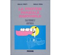 La protesi parziale rimovibile
