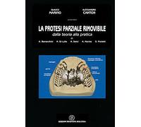 La protesi parziale rimovibile - Dalla teoria alla pratica