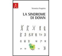 La sindrome di Down