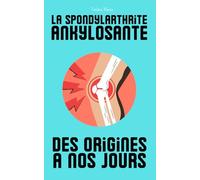 La spondylarthrite ankylosante, des origines à nos jours: un voyage captivant à travers l’histoire de cette maladie méconnue