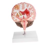 Laboratorio Di Strumenti Didattici Per Modelli Anatomici Di Malattie Del