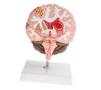 Laboratorio Di Strumenti Didattici Per Modelli Anatomici Di Malattie Del