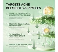 LANBENA Siero di acne spot, lozione di essiccazione dell'acne, trattamento dell'acne durante la notte per il viso, asciugare brufoli, impurità, brufoli e pulire i pori, 0.42 oncia fluida