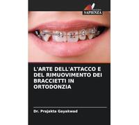 L'ARTE DELL'ATTACCO E DEL RIMUOVIMENTO DEI BRACCIETTI IN ORTODONZIA