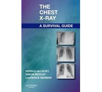 The Chest X-Ray: A Survival Guide