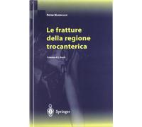 Le fratture della regione trocanterica - [Springer Italia]