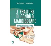 Le fratture di condilo mandibolare. Protocollo di gestione