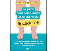Le guide pour comprendre et se libérer du lipoedème: Les jambes poteaux ne sont pas une honte, elles sont une maladie que l'on peut apprivoiser