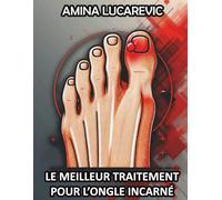 LE MEILLEUR TRAITEMENT POUR L’ONGLE INCARNÉ: POUR LES SPORTIFS ET AUTRES / QUI ONT ÉTÉ OPÉRÉS POUR UN ONGLE INCARNÉ SANS TROUVER DE SOLUTION.