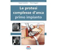 Le protesi complesse d'anca. Primo impianto