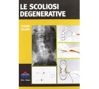 Le scoliosi degenerative