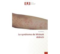 Le syndrome de Wiskott Aldrich