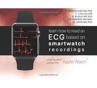 Learn how to read an ECG based on smartwatch recordings: case studies from the Apple Watch (black and white edition)