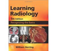 Learning Radiology: Recognizing the Basics