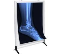 LED X-Ray Film Viewer Light Box - Ultra Thin Illuminator with Acrylic Panel, Adjustable Knob Dimming, Flicker-Free Uniform Lighting for Clinics, Hospitals & Dental Offices(49.5 * 40.5cm)