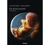 Lennart Nilsson Lars Hamberger Imke Ein Kind entsteht - Der (Copertina rigida)