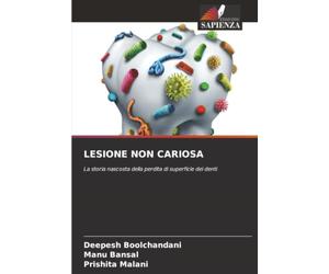 LESIONE NON CARIOSA: La storia nascosta della perdita di superficie dei denti