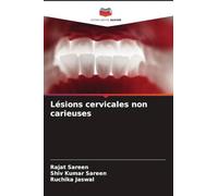 Lésions cervicales non carieuses