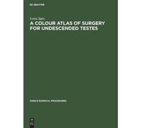 Lewis Spitz A Colour Atlas of Surgery for Undescended Testes (Copertina rigida)