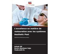 L'excellence en matière de restauration avec les systèmes Aesthetic Post: Systèmes esthétiques postaux