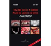Libri Banzi Claudio / Guido Corti - Evoluzione Digitale In Chirurgia Implantare