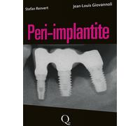 Libri Stefan Renvert - Peri-implantite - 2014