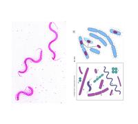 LIEDER Preparati microscopici batteri, 6 preparati