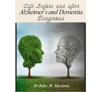 Life before and After an Alzheimer's or Dementia Diagnosis