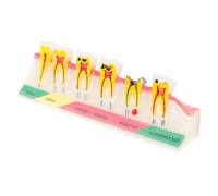 LIFKICH Modello Didattico di Denti in Resina per Presentazioni Educative, Leggero e Portatile, per Spiegare L'evoluzione della Carie in Ambito Medico e Scolastico