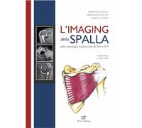 L'imaging della spalla. Dalla radiologia tradizionale all'artro-RM