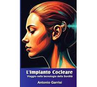 L'Impianto Cocleare: Viaggio nella tecnologia della Sordità