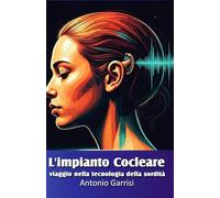 L'Impianto Cocleare: Viaggio nella tecnologia della Sordità