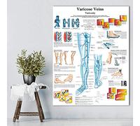 Ling88 Poster da Parete Vene Varicose Grafico Poster Stampa su Tela Pittura Immagini A Parete per L'Educazione Medica Medici Ufficio Aula Poster E Stampe - 50X70 Cm