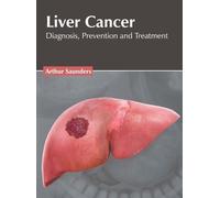 Liver Cancer: Diagnosis, Prevention and Treatment (Copertina rigida)