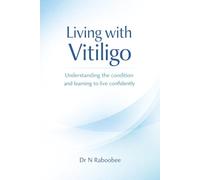 Living with Vitiligo: Understanding the condition and learning to live confidently
