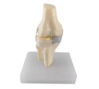 LKYLVEE Modello di articolazione del Ginocchio con condilo Singolo - Modello di Sostituzione Totale del Ginocchio - Strumento didattico anatomico,B,15cm